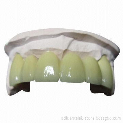 Emax with 360 to 400MPa Flexural Strength